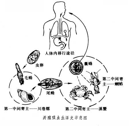 是由斯氏肺吸虫(paragonimus skrjabini)寄生人体所致,其蚴虫在体内各