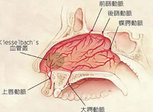 鼻腔前部出血图集