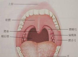 异物多存留于扁桃体,舌根或会厌谷,常为细小的异物,易刺入组织内或