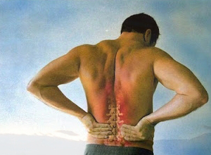 背部酸痛