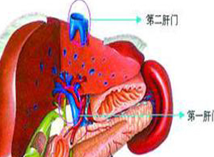 肝静脉回流障碍