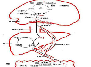 高氨血症