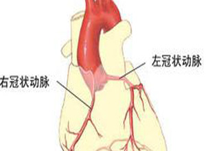 冠状动脉供血不足