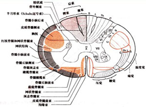 脊髓丘脑束受压图集