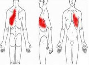 肩胛放射性疼痛