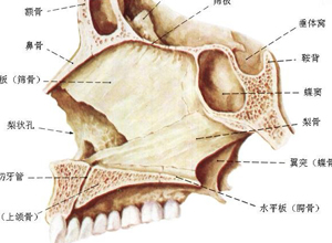 鼻中隔向一侧或两则弯曲