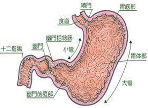 溃疡龛影