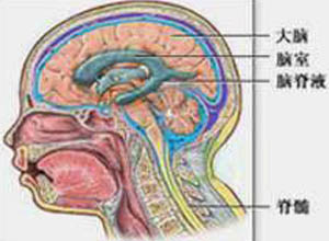 脑脊液鼻漏