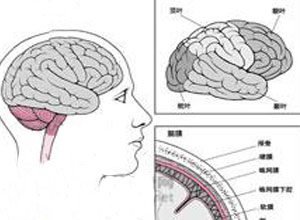 脑衰弱综合征