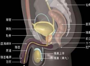 前列腺硬结