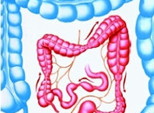 麻痹性肠梗阻图片