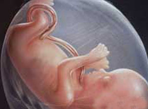 胎儿生长发育迟缓