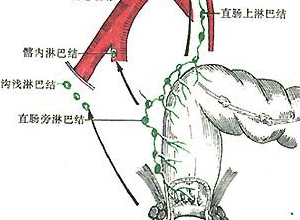 耻骨直肠肌痉挛性肥大