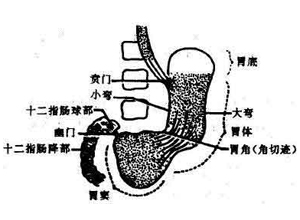 胃窦的解剖位置示意图图片