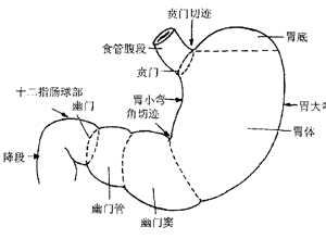 胃危象