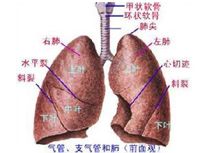 吸入综合征