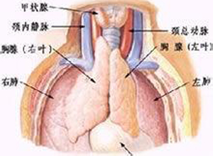 胸腺缺如