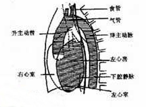 悬垂型心脏