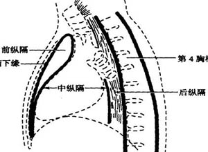 纵隔病变纵隔疾病包括纵隔肿瘤(良性及恶性),囊肿,急,慢性纵隔炎,纵