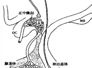 产后垂体坏死